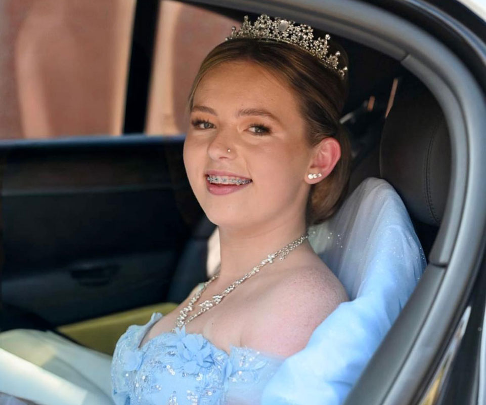 Fixed ceramic braces