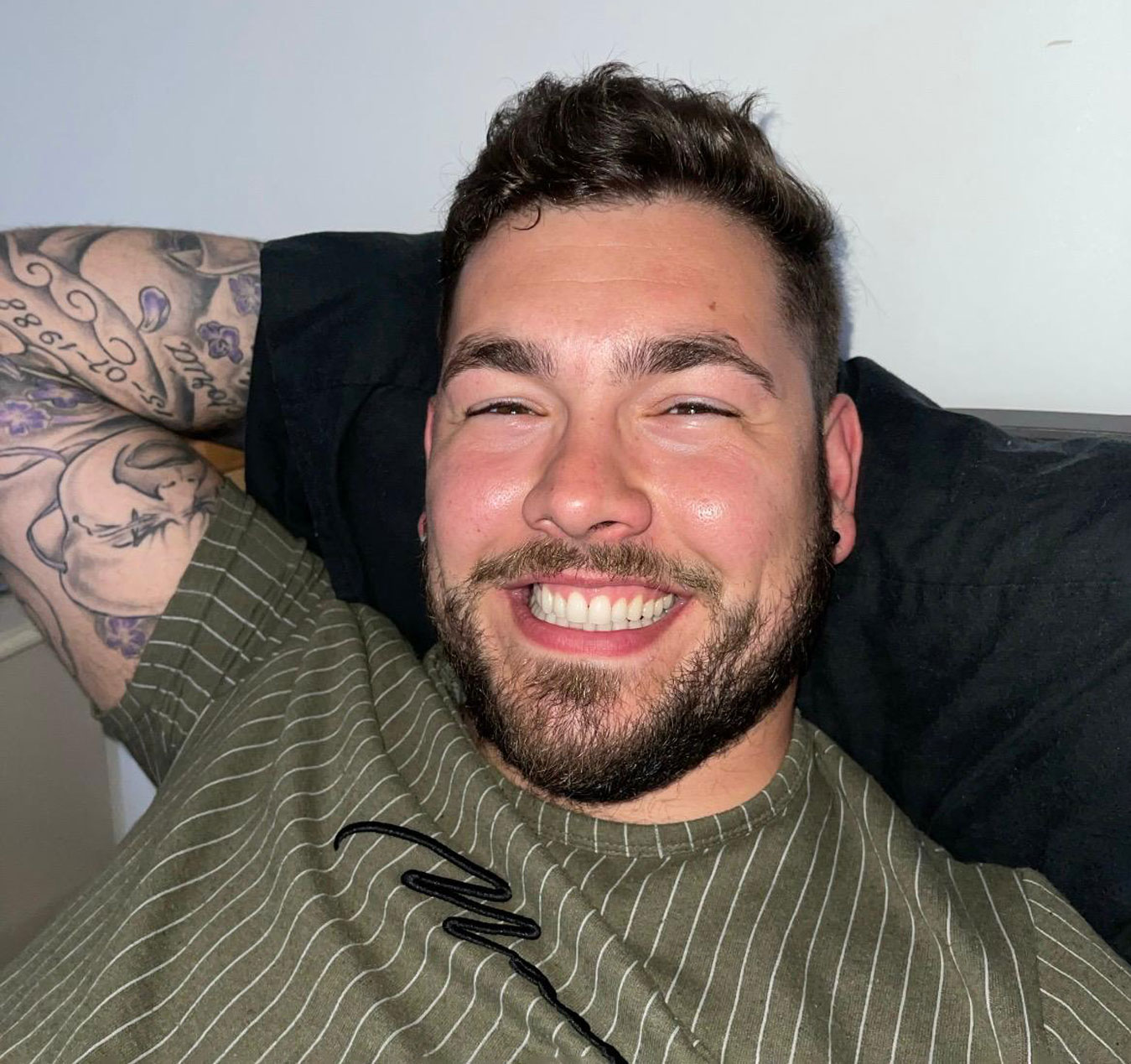 Do I need to whiten my teeth?