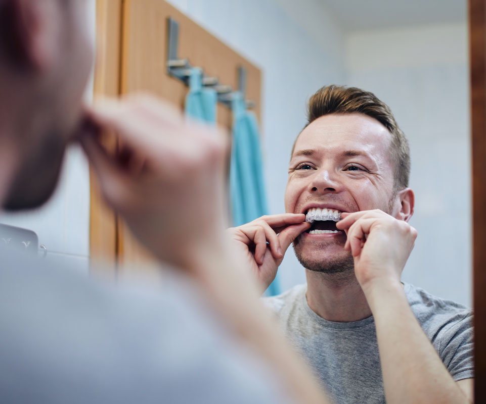 Invisalign®
for adults Invisalign®
for adults