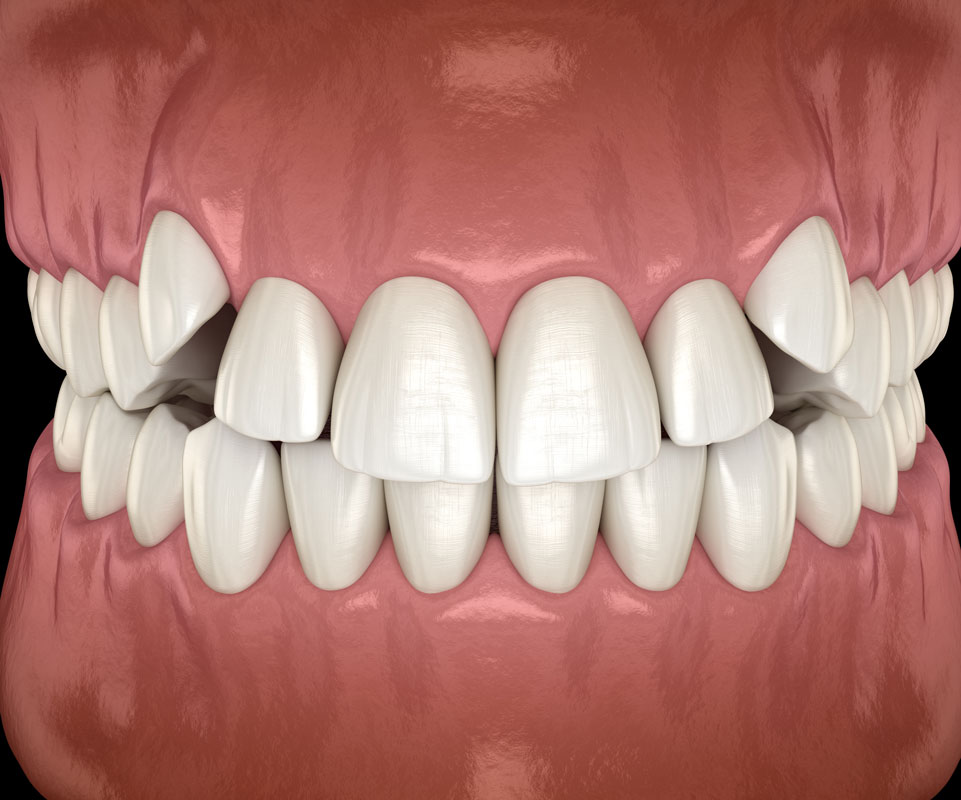 Common orthodontic problems we treat Common orthodontic problems we treat